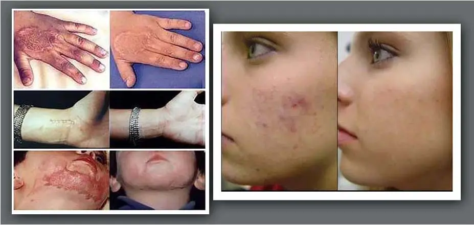 Cara Mudah Membersihkan Alat Masak Bekas Babi dengan Aman dan Efektif