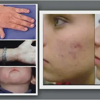 Cara Mudah Membersihkan Alat Masak Bekas Babi dengan Aman dan Efektif